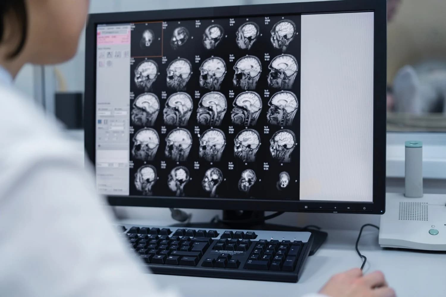 Função cerebral começa a cair aos 44 e acelera aos 67, aponta estudo
